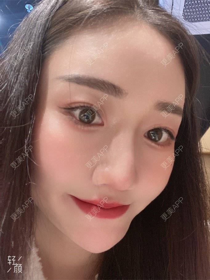 更美 - 更美用户KypVf5ovVE的经验 | 上海