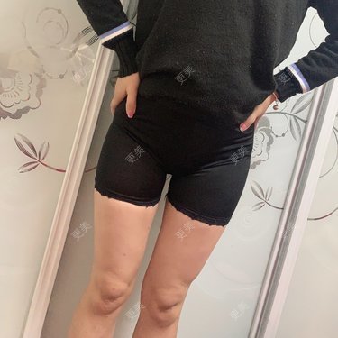 更美用户zfynm75ree的吸脂瘦大腿日记