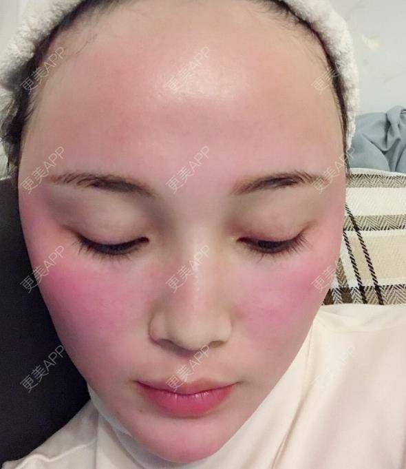 更美用户cbpKn9ADNI的菲欧曼