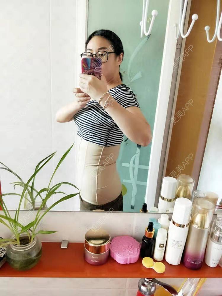 芝麻女士的腰腹吸脂日记