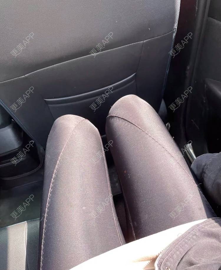 更美用户dhmb6eir10的吸脂瘦大腿日记