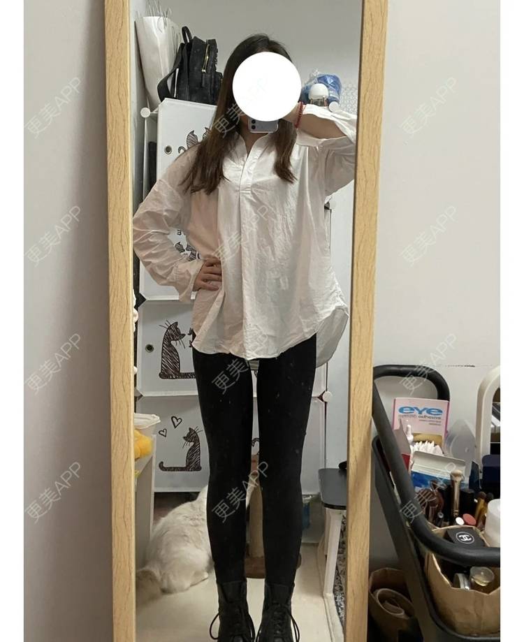 吸脂瘦大腿前后对比照_更美用户itdbqj74rn吸脂瘦大腿前后对比照_术后