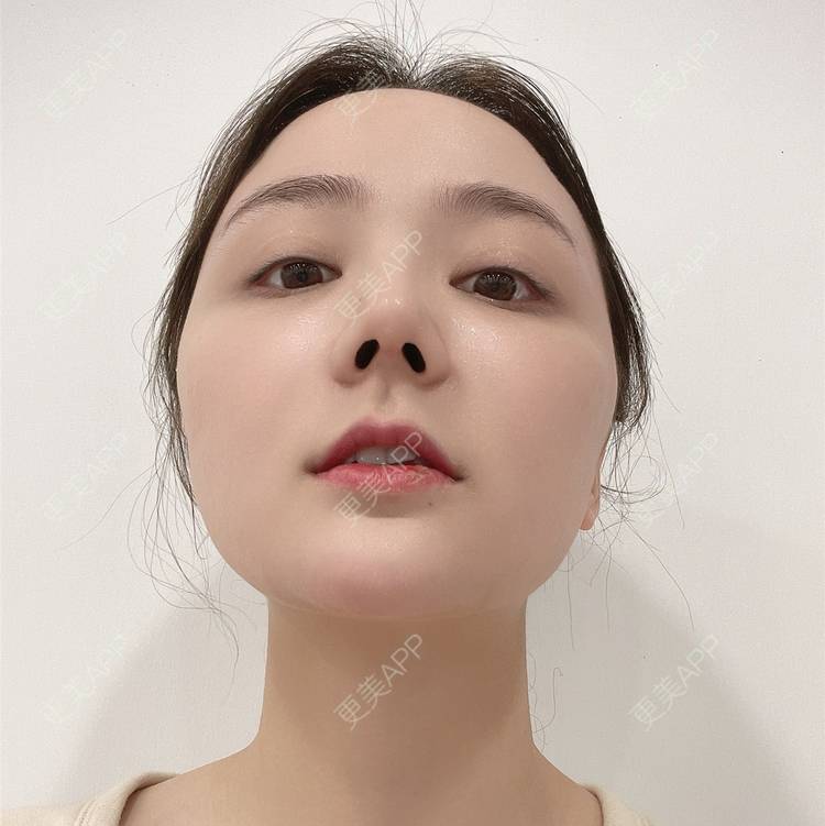 馨雨瑶长的鼻综合日记