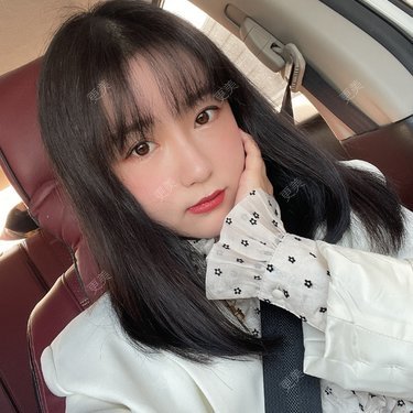 丰面颊前后效果对比 丰面颊前后对比图 恢复过程图 更美app官网