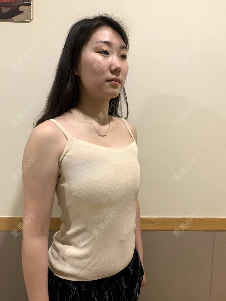 彩色的朝霞的假体隆胸日记