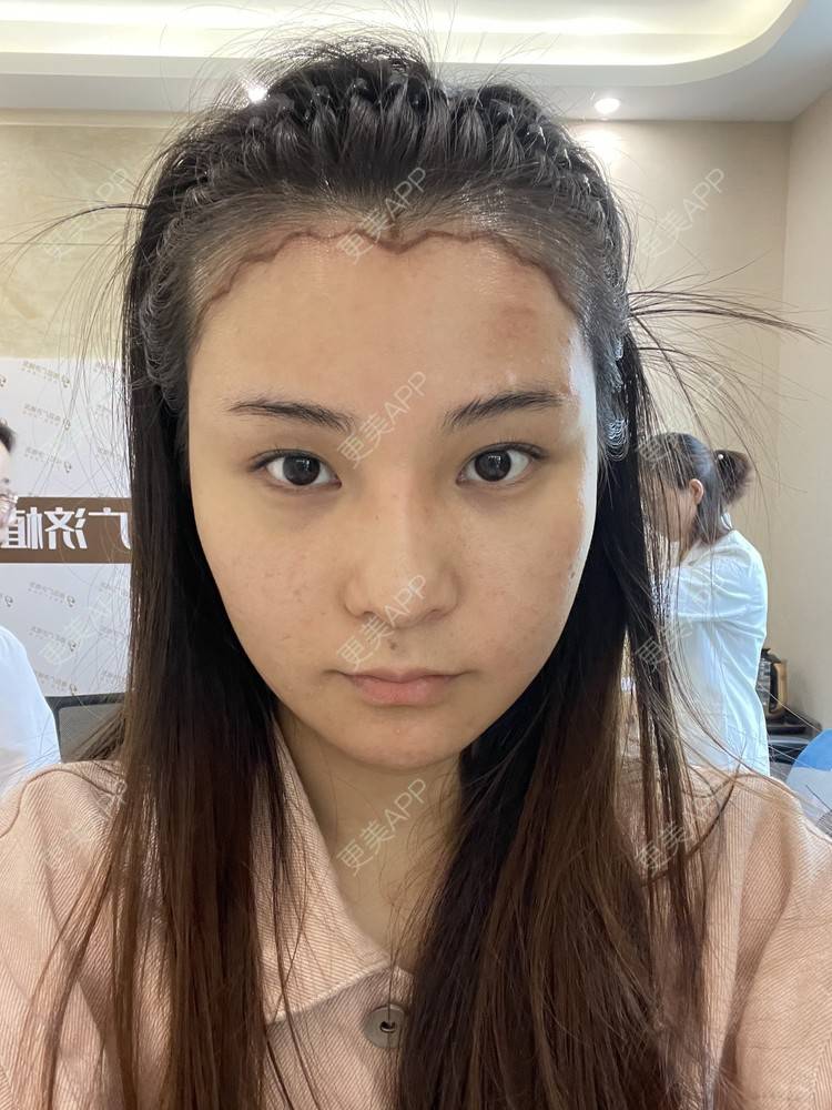 南昌植发论坛(南昌植发论坛最新消息)