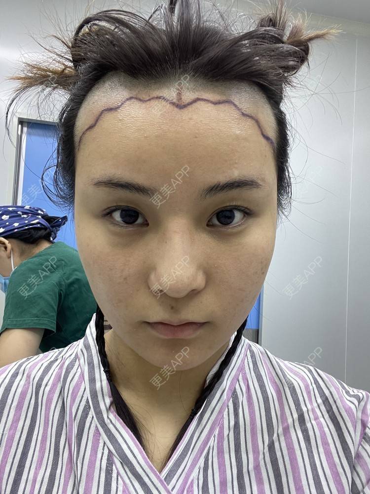 南昌哪里有植发(南昌有植发医院吗)