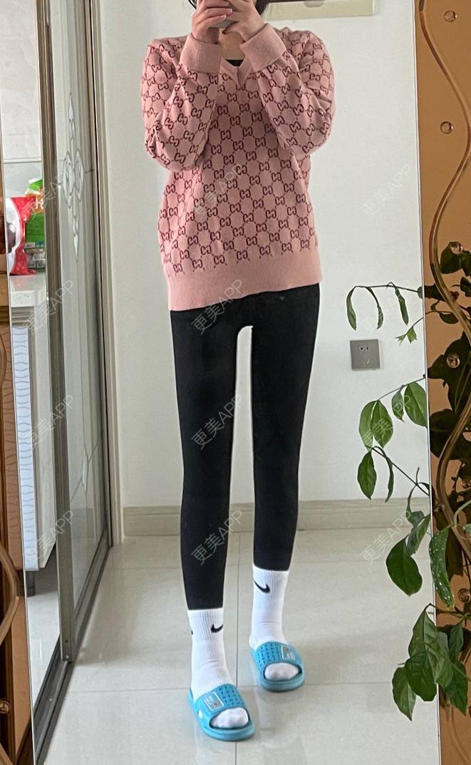 更美用户iz5lwpyi8q的吸脂瘦大腿日记