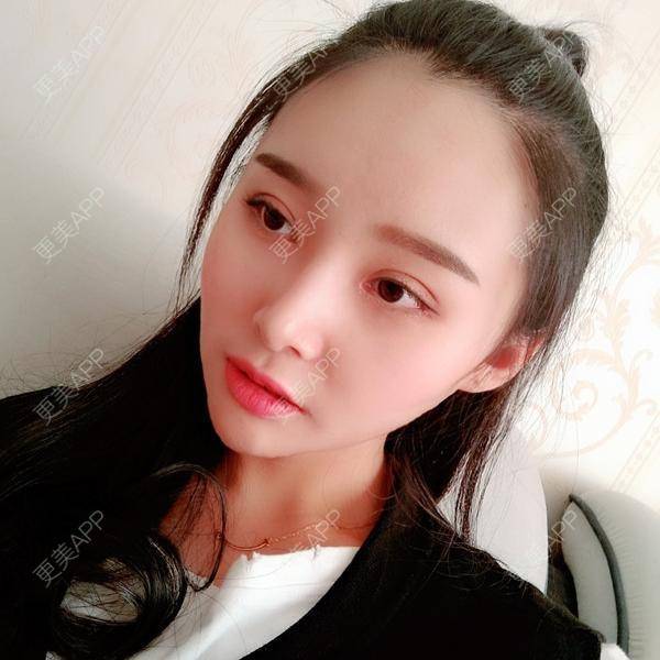 更美 - 长沙雨花脸博士医疗门诊部的鼻部多项经验 | 全切双眼皮 | 鼻部多项 | 眼部多项
