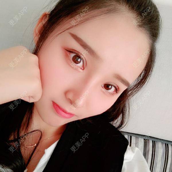更美 - 长沙雨花脸博士医疗门诊部的鼻部多项经验 | 全切双眼皮 | 鼻部多项 | 眼部多项