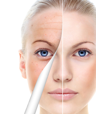 更美用户catngxq1ky的除皱套餐日记