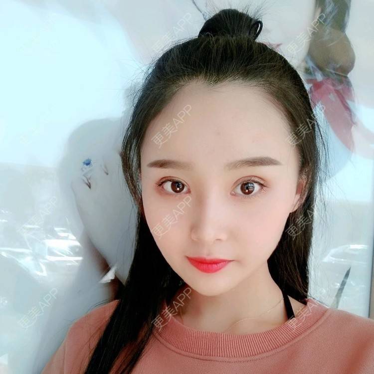 更美 - 长沙雨花脸博士医疗门诊部的鼻部多项经验 | 鼻部多项 | 全切双眼皮 | 眼部多项