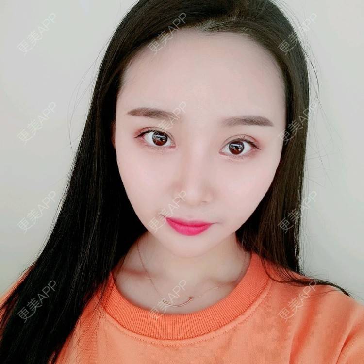 更美 - 长沙雨花脸博士医疗门诊部的鼻部多项经验 | 鼻部多项 | 全切双眼皮 | 眼部多项