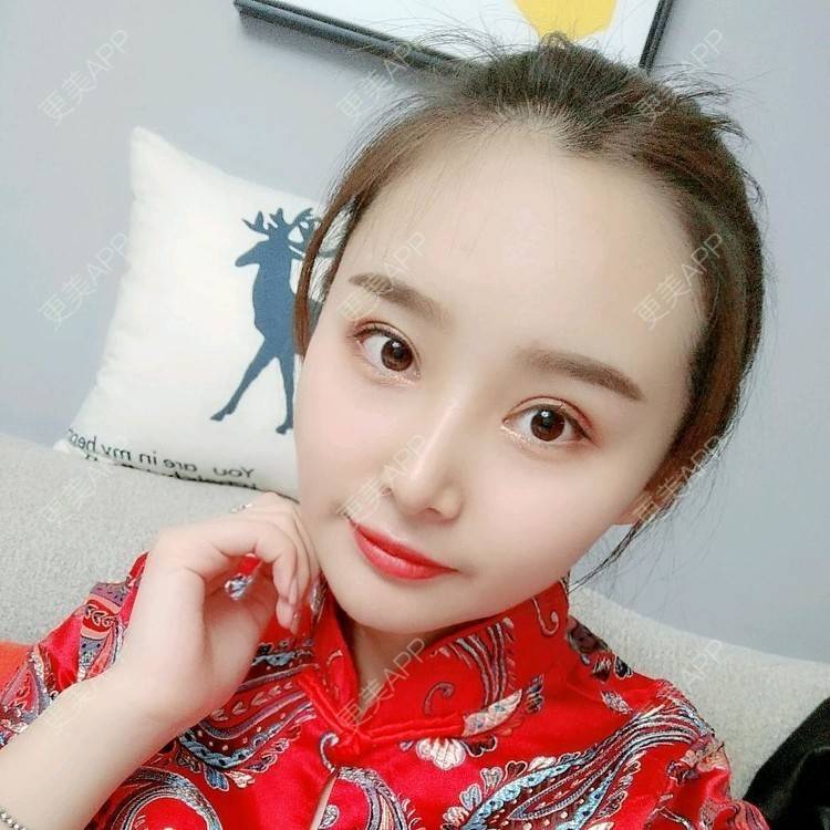 更美 - 长沙雨花脸博士医疗门诊部的鼻部多项经验 | 鼻部多项 | 全切双眼皮 | 眼部多项