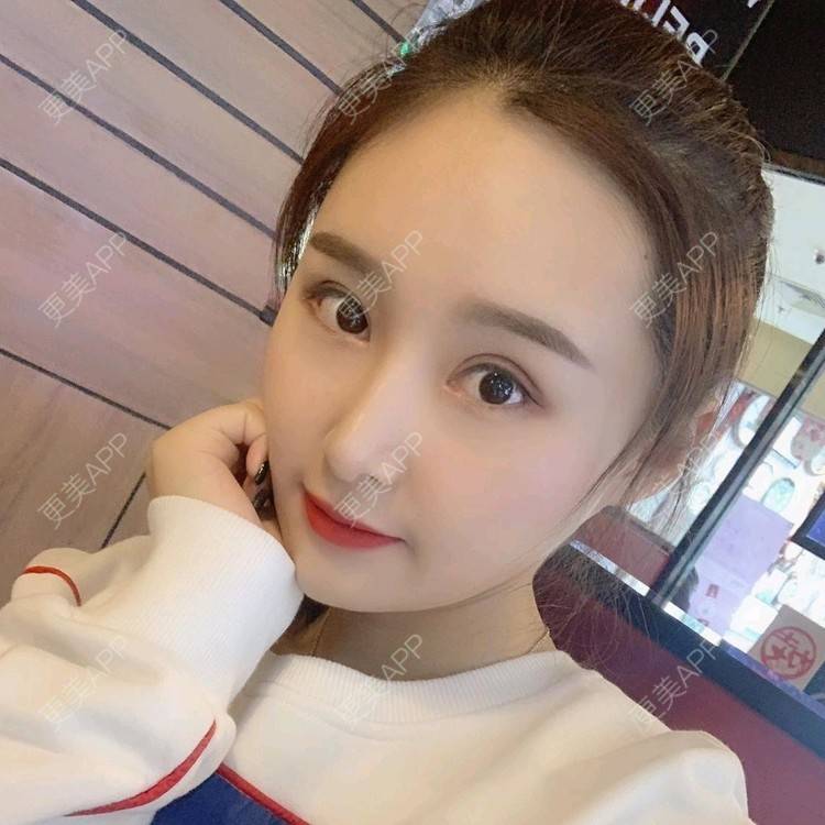 更美 - 长沙雨花脸博士医疗门诊部的鼻部多项经验 | 鼻部多项 | 全切双眼皮 | 眼部多项