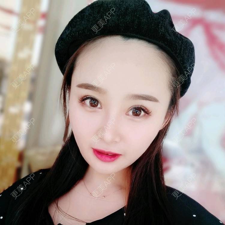 更美 - 长沙雨花脸博士医疗门诊部的鼻部多项经验 | 鼻部多项 | 全切双眼皮 | 眼部多项