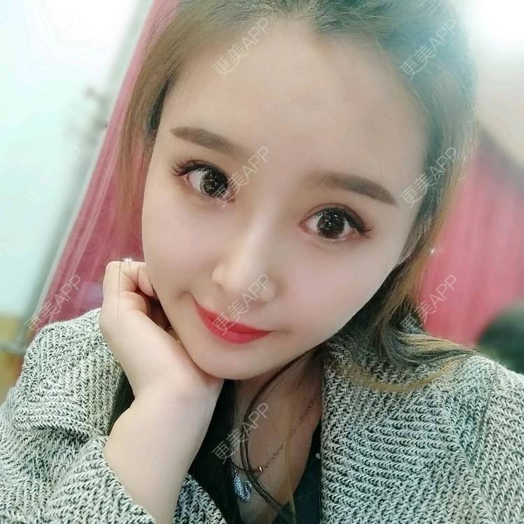更美 - 长沙雨花脸博士医疗门诊部的鼻部多项经验 | 鼻部多项 | 全切双眼皮 | 眼部多项