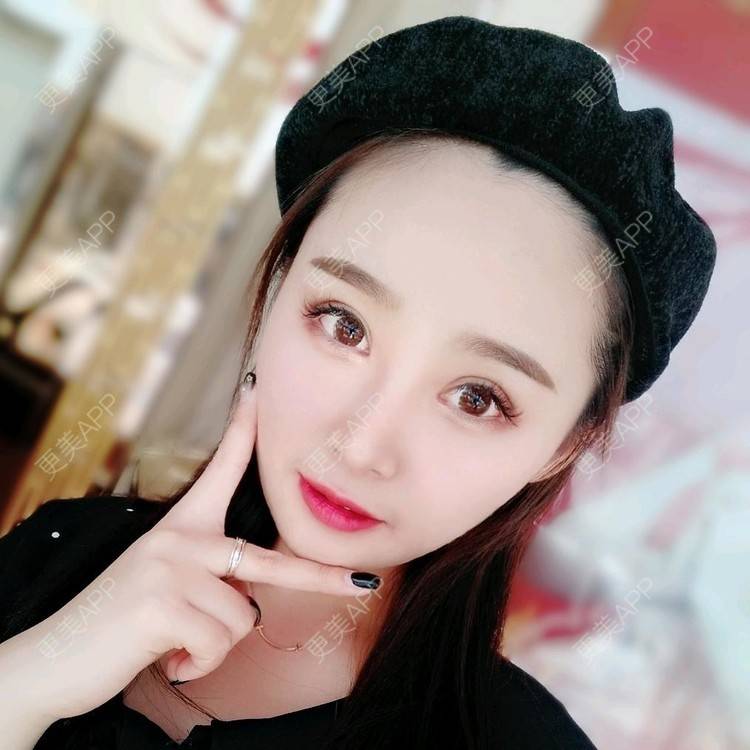 更美 - 长沙雨花脸博士医疗门诊部的鼻部多项经验 | 鼻部多项 | 全切双眼皮 | 眼部多项