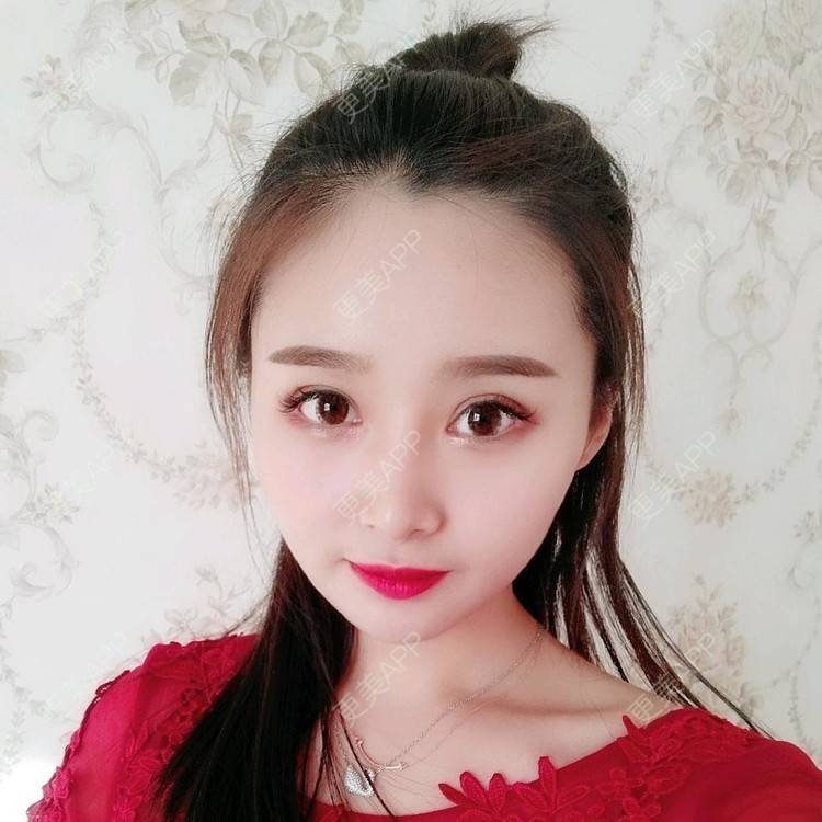 更美 - 长沙雨花脸博士医疗门诊部的鼻部多项经验 | 鼻部多项 | 全切双眼皮 | 眼部多项