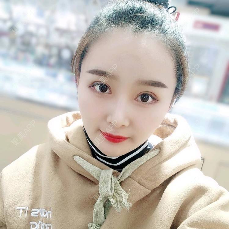 更美 - 长沙雨花脸博士医疗门诊部的鼻部多项经验 | 鼻部多项 | 全切双眼皮 | 眼部多项