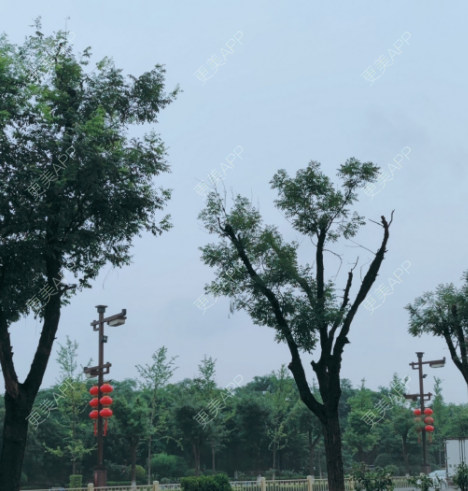 更美 - 更美用户UwLVRJ9P8W的阴唇整形经验 | 广州 | 阴唇整形