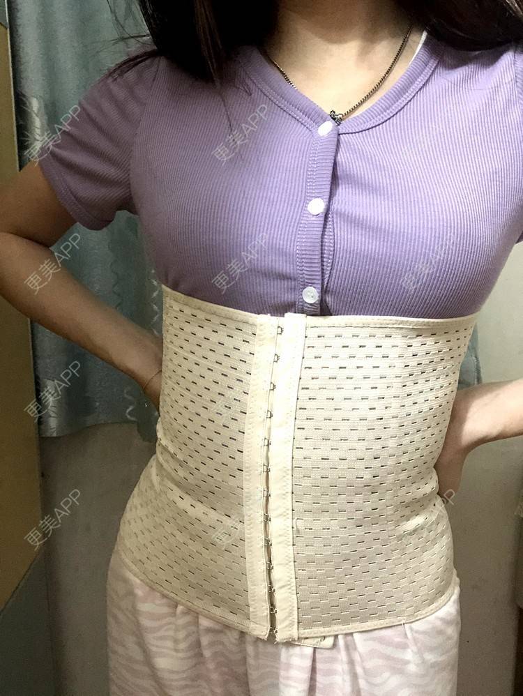 更美用户yejztzcuwx的腰部吸脂日记