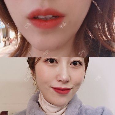 重庆沙坪坝玺悦台医疗美容门诊有限公司