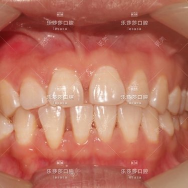乐莎莎口腔