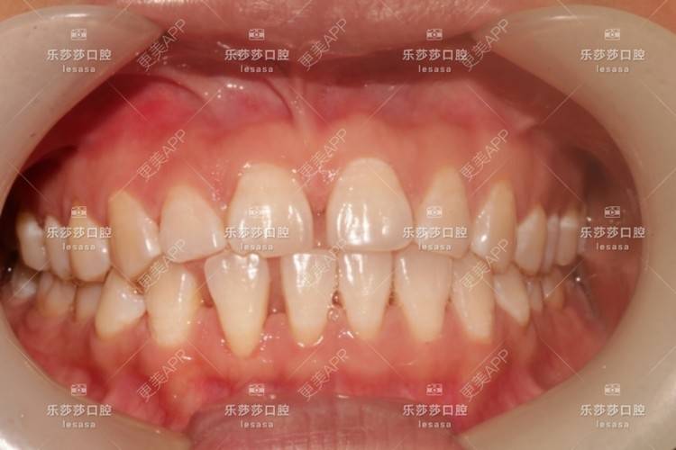 更美 - 乐莎莎口腔的经验