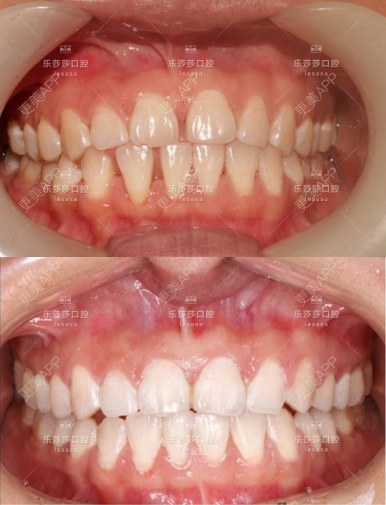 更美 - 乐莎莎口腔的经验