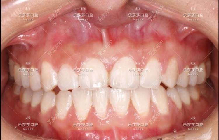 更美 - 乐莎莎口腔的经验