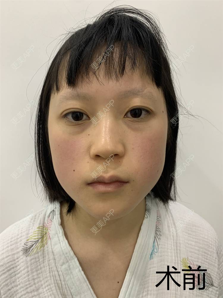 更美 - 粉红小熊喵的眼部多项经验 | 眼部多项