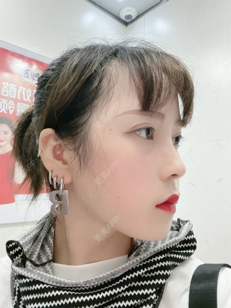 更美 - 粉红小熊喵的眼部多项经验 | 眼部多项