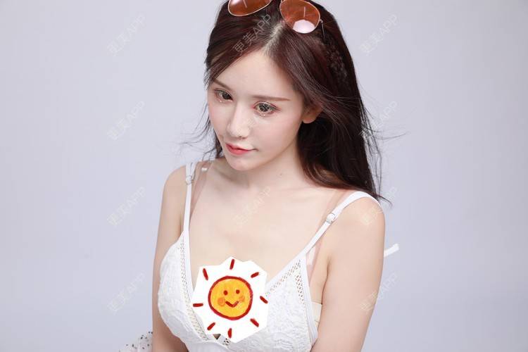 丰胸 | 胸部下垂矫正 | 广州 | 隆胸假体取出 | 胸部套餐 | 美胸套餐