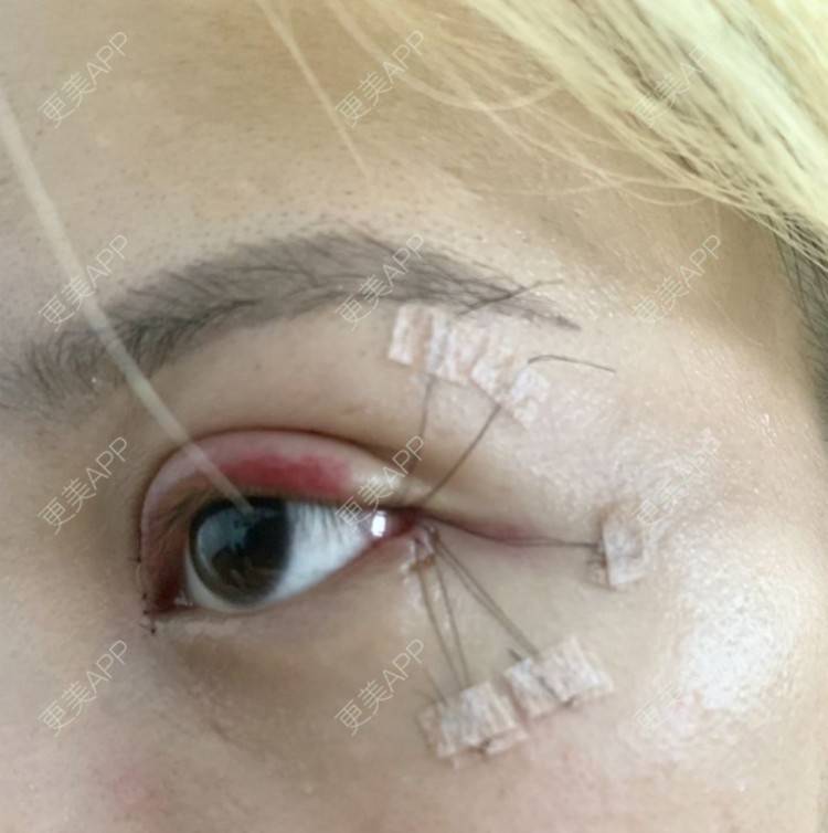 更美用户oyagpycvxm的开外眼角日记