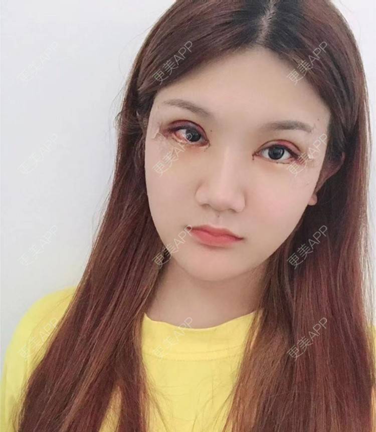 更美用户bouo3kpbhc的开外眼角日记