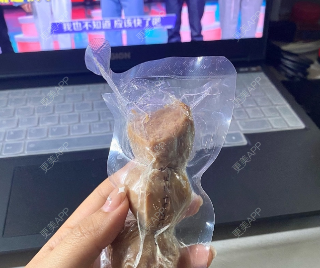 更美 - 更美用户iHK8dWuL1M的阴唇整形经验 | 广州 | 阴唇整形