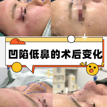 李闯 医生