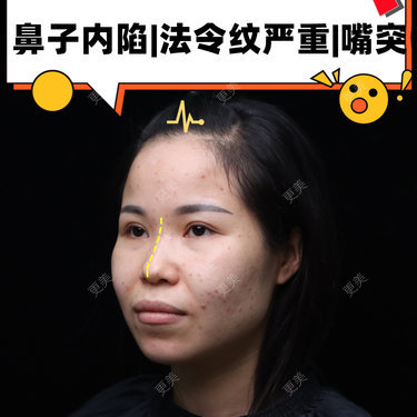 李闯 医生