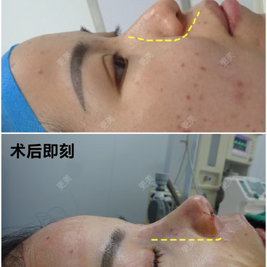 李闯 医生
