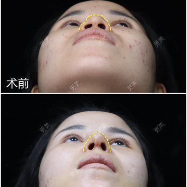 李闯 医生