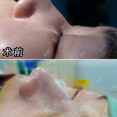 李闯 医生