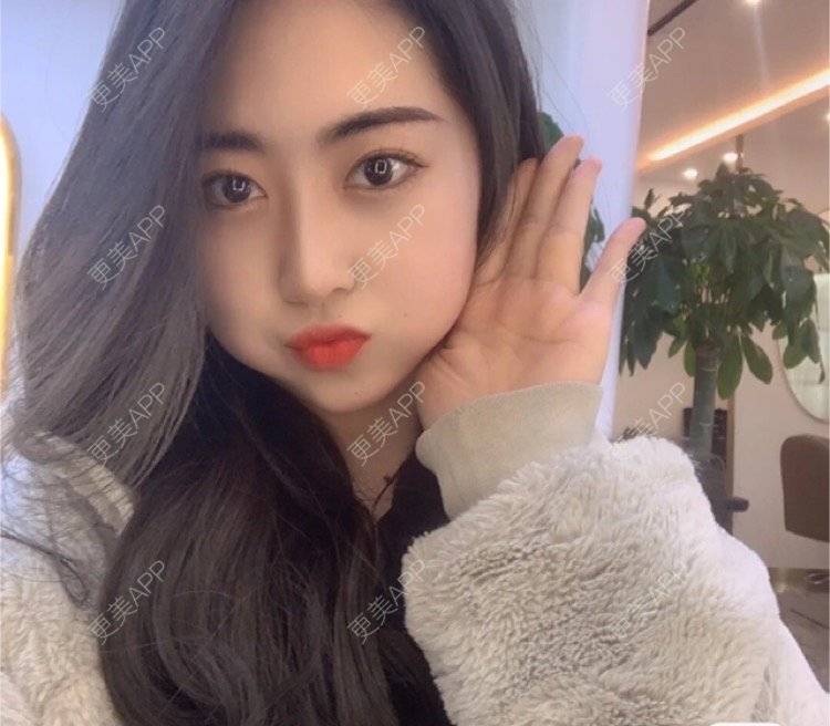 更美 - 刘金丹 医生的定点双眼皮经验 | 定点双眼皮 | 南昌