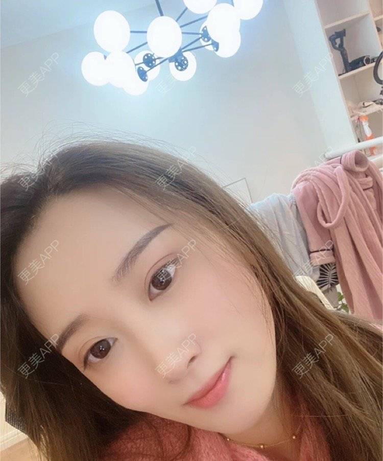 更美 - 刘金丹 医生的定点双眼皮经验 | 定点双眼皮 | 南昌