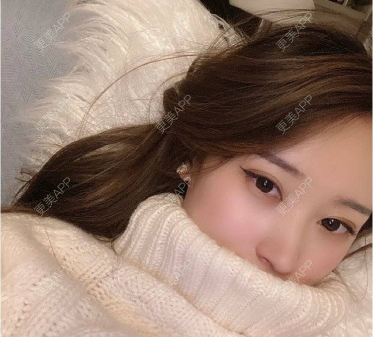 更美 - 刘金丹 医生的定点双眼皮经验 | 定点双眼皮 | 南昌