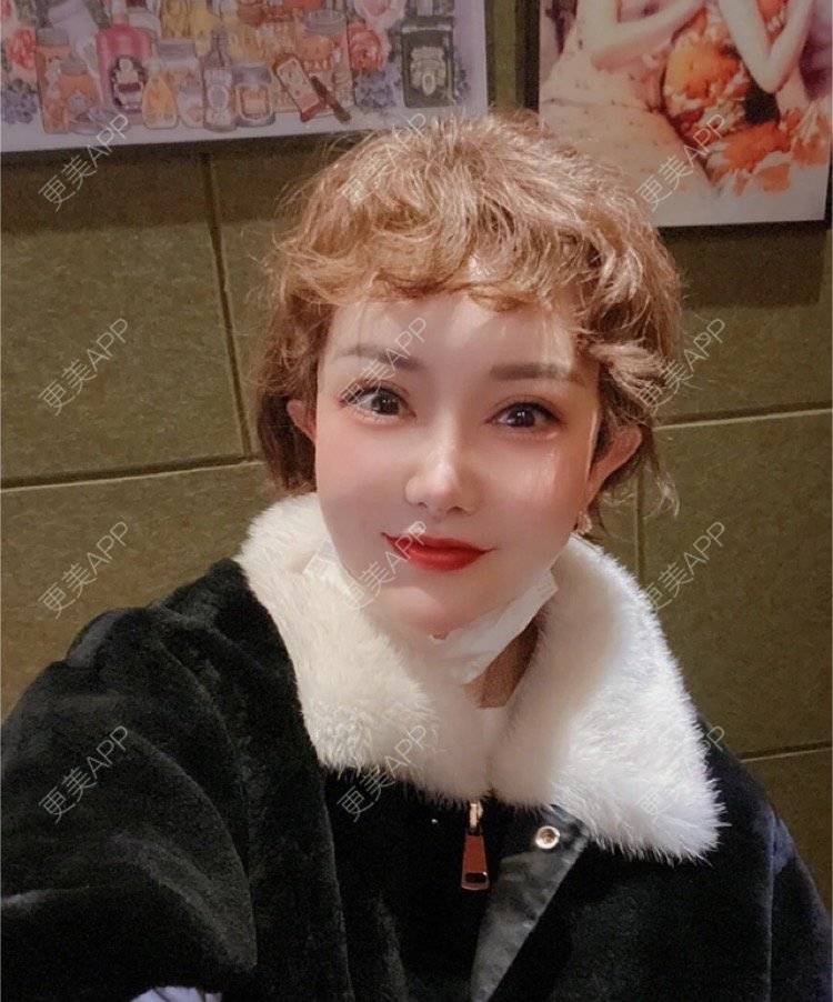 更美 - 刘金丹 医生的定点双眼皮经验 | 定点双眼皮 | 南昌