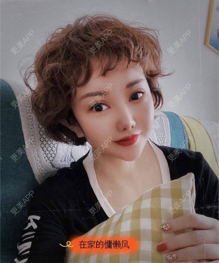 更美 - 刘金丹 医生的定点双眼皮经验 | 定点双眼皮 | 南昌