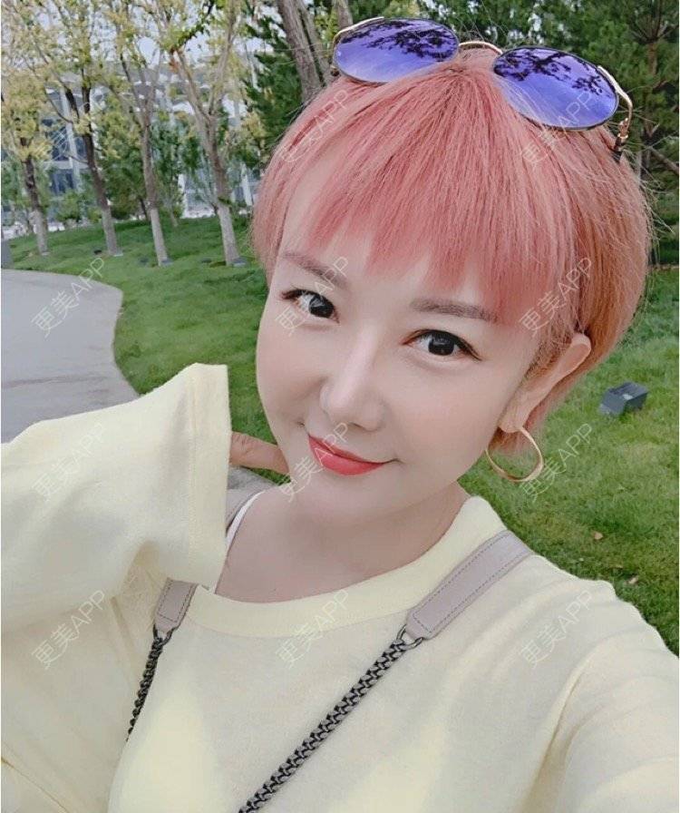 更美 - 刘金丹 医生的定点双眼皮经验 | 定点双眼皮 | 南昌