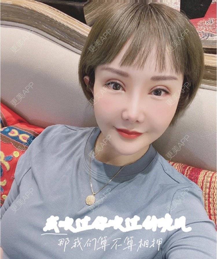 更美 - 刘金丹 医生的定点双眼皮经验 | 定点双眼皮 | 南昌