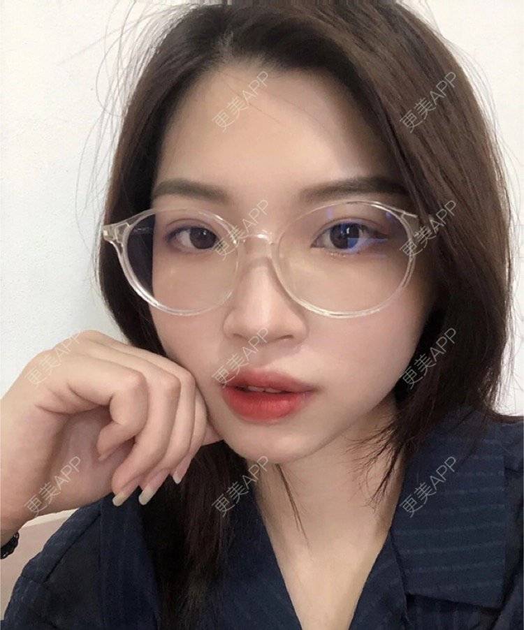 更美 - 刘金丹 医生的定点双眼皮经验 | 定点双眼皮 | 南昌